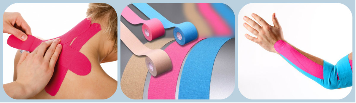 Кинезиотейпирование